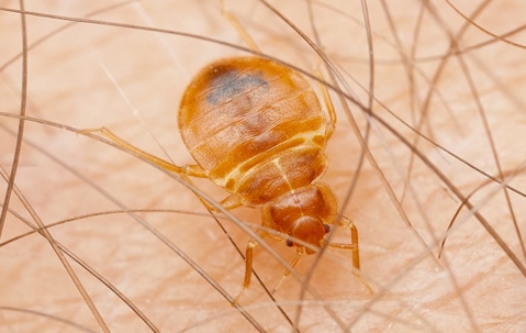 bed bug biting skin